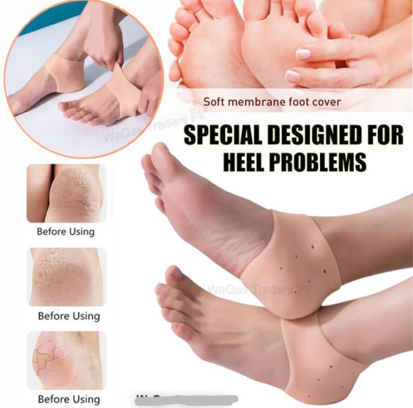 Half Heel Pain Anti Crack Silicone Set – Anti Crack For Pain Relief Unisex